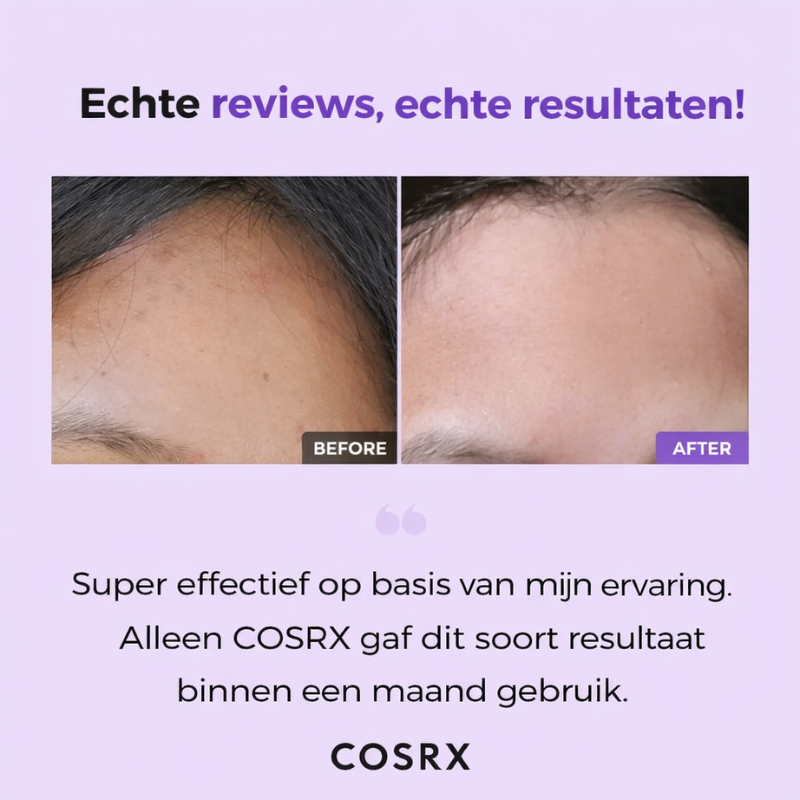 COSRX – Clarifying Treatment Toner | Zuivere & Gelijkmatige Huid