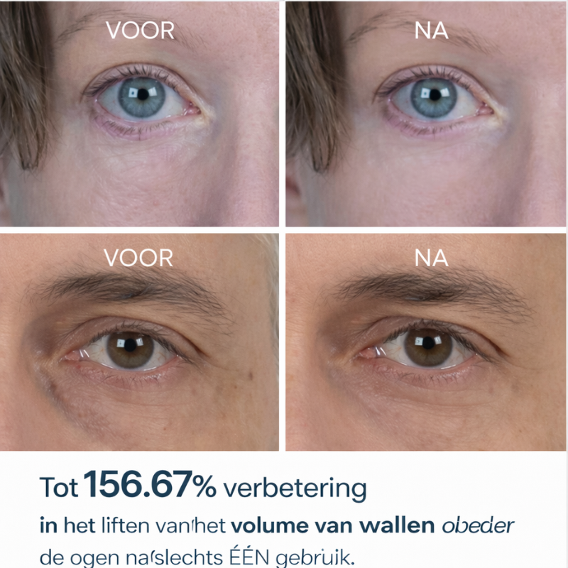 Dr. Melaxin – Eye Lift Cream | Vermindert Wallen met Liftend Effect