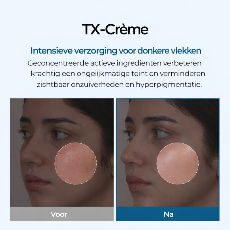 Dr. Melaxin – Pigment Correcting Cream | vermindert Donkere vlekken