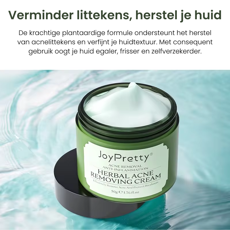 JoyPretty – Acne crème ontstekingen & littekens