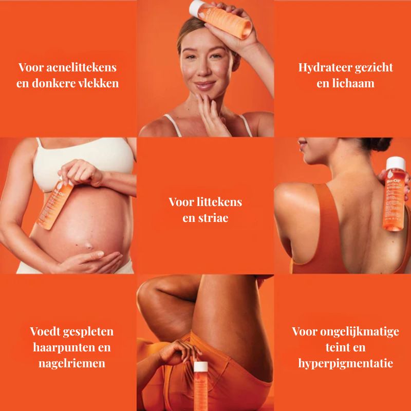 Bio-Oil - Hydratatie en verzorging van littekens en stretch marks